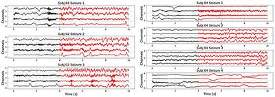 Multi-Centroid Hyperdimensional Computing Approach for Epileptic Seizure Detection